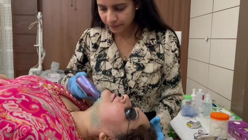 HIFU for Double Chin Reduction